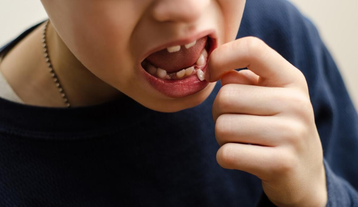 别以为晚上睡觉嘴发干是什么原因,夜晚睡觉嘴唇发干怎么回事