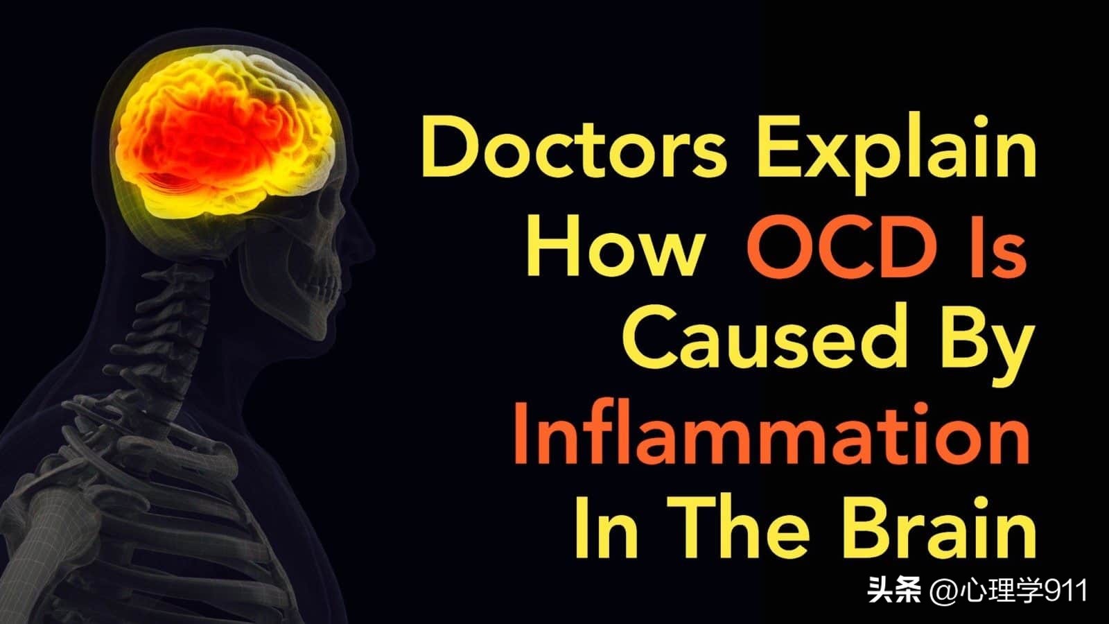 你了解什么是抑郁症吗,你以为的强迫症和真实的强迫症