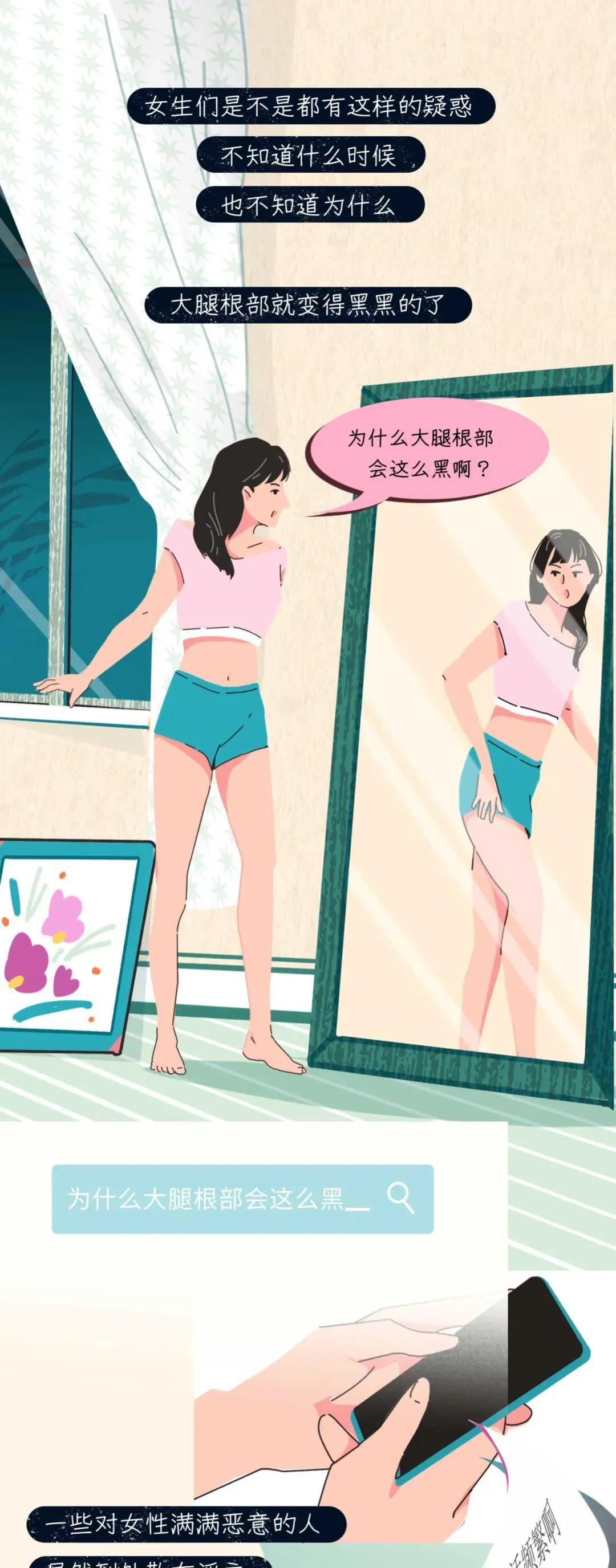 大腿两侧皮肤变黑是为什么呀,为啥女孩子大腿会淤黑