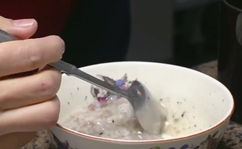 韩国大爷脑袋里有蜘蛛后续,72岁大叔脑里有蜘蛛