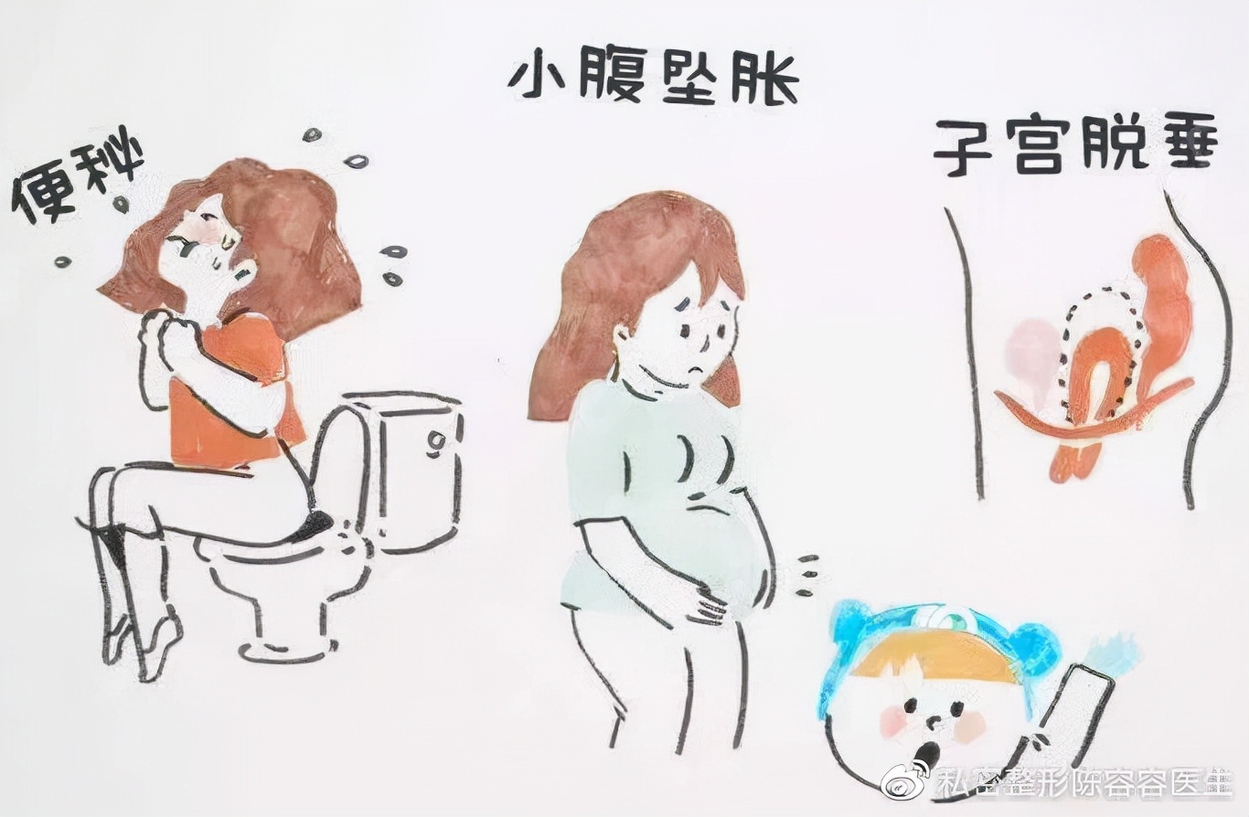 产后怎么修复盆底肌和腹直肌,产后修复盆底肌和腹直肌手法