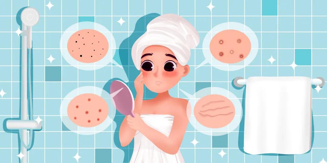 眼周皮肤过敏红痒干燥紧绷怎么办,皮肤干燥又痒什么办法解决