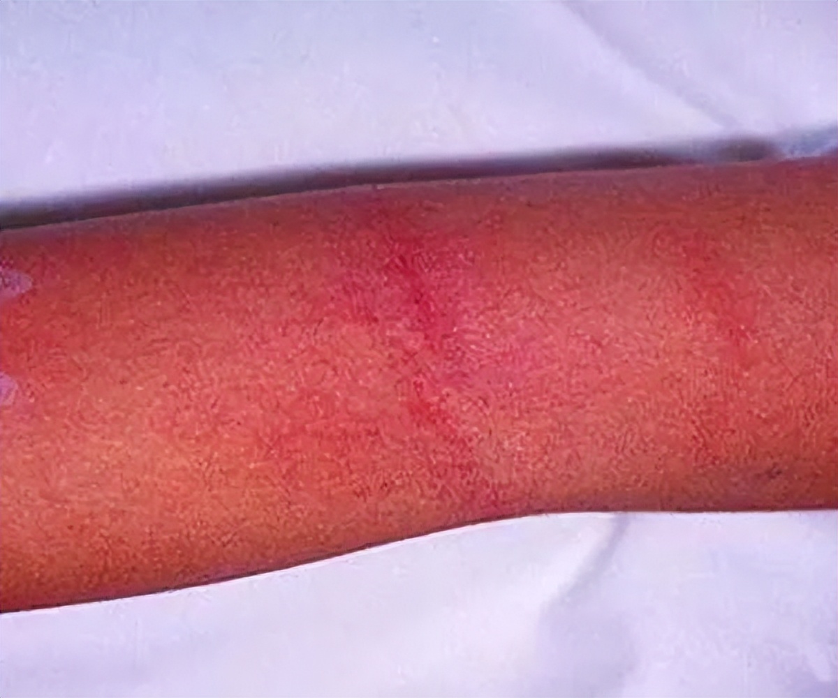 小孩的舌头出现小红点点,小儿舌头的各种症状如何解决