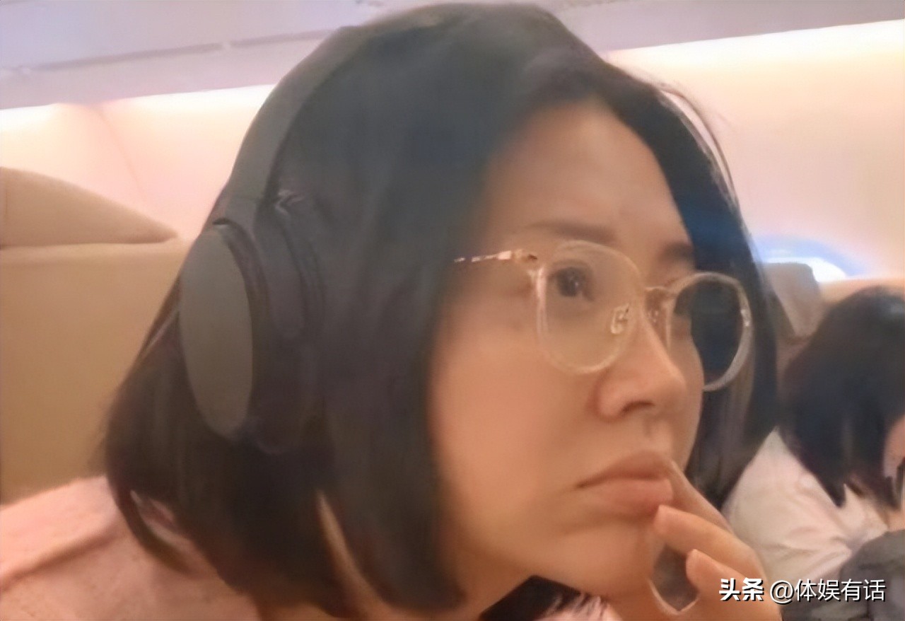 面部衰老皱纹图,面部衰老皱纹解剖图