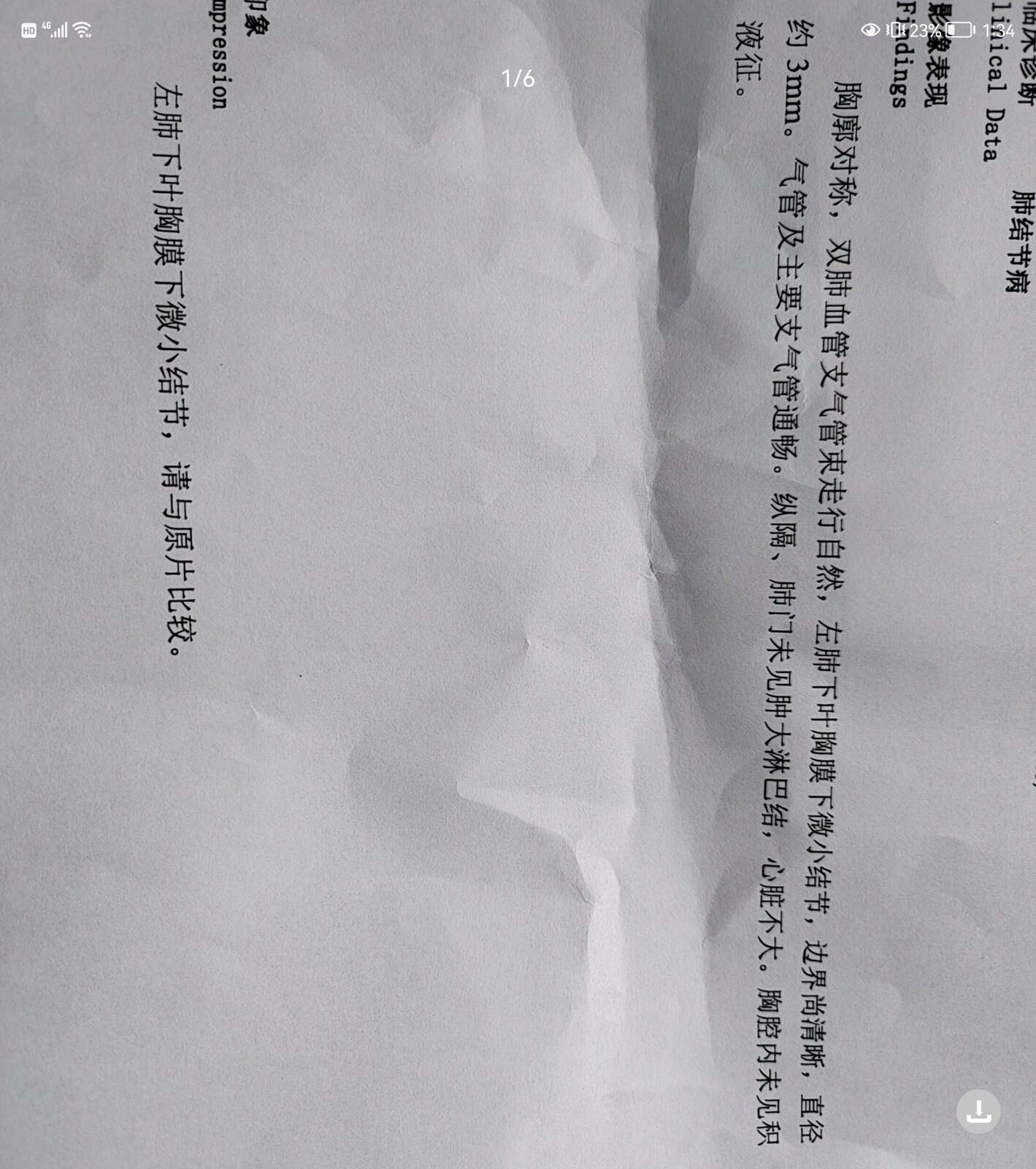 刘懿博士说肺癌微浸润,刘懿博士说肺结节