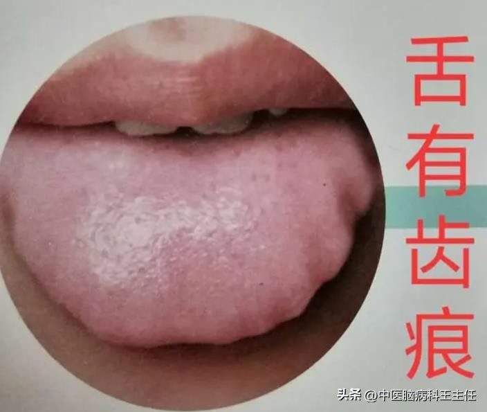 总是焦虑怎么调整,严重焦虑抑郁怎么拯救自己