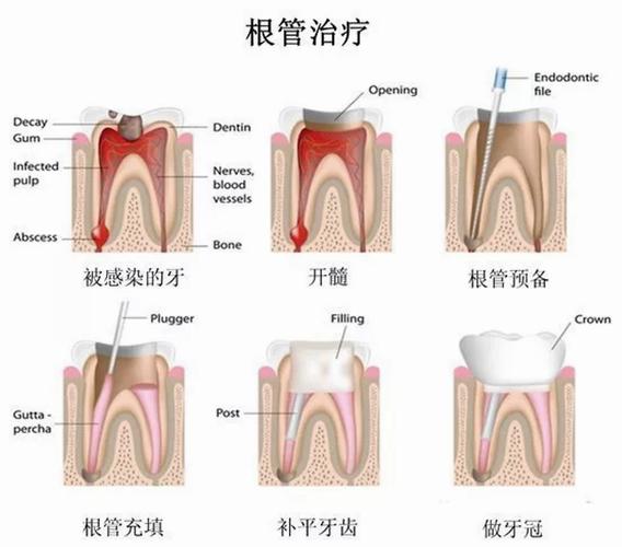 告别牙周炎的烦恼,告别牙痛