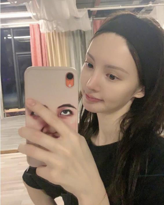 盘点女明星发际线危机,女明星秃头前后对比