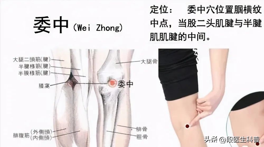 急性腰扭伤针灸什么穴位,急性腰扭伤针灸穴位图