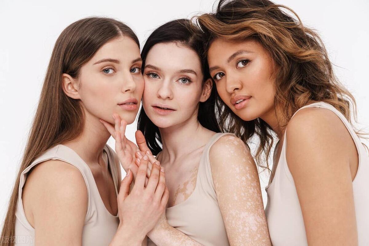 要想白癜风早日康复，这些关键点你做到了吗？