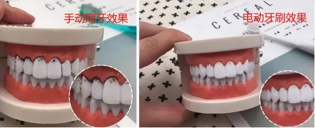 儿童u型电动牙刷测评红黑榜,口碑最好儿童电动牙刷测评