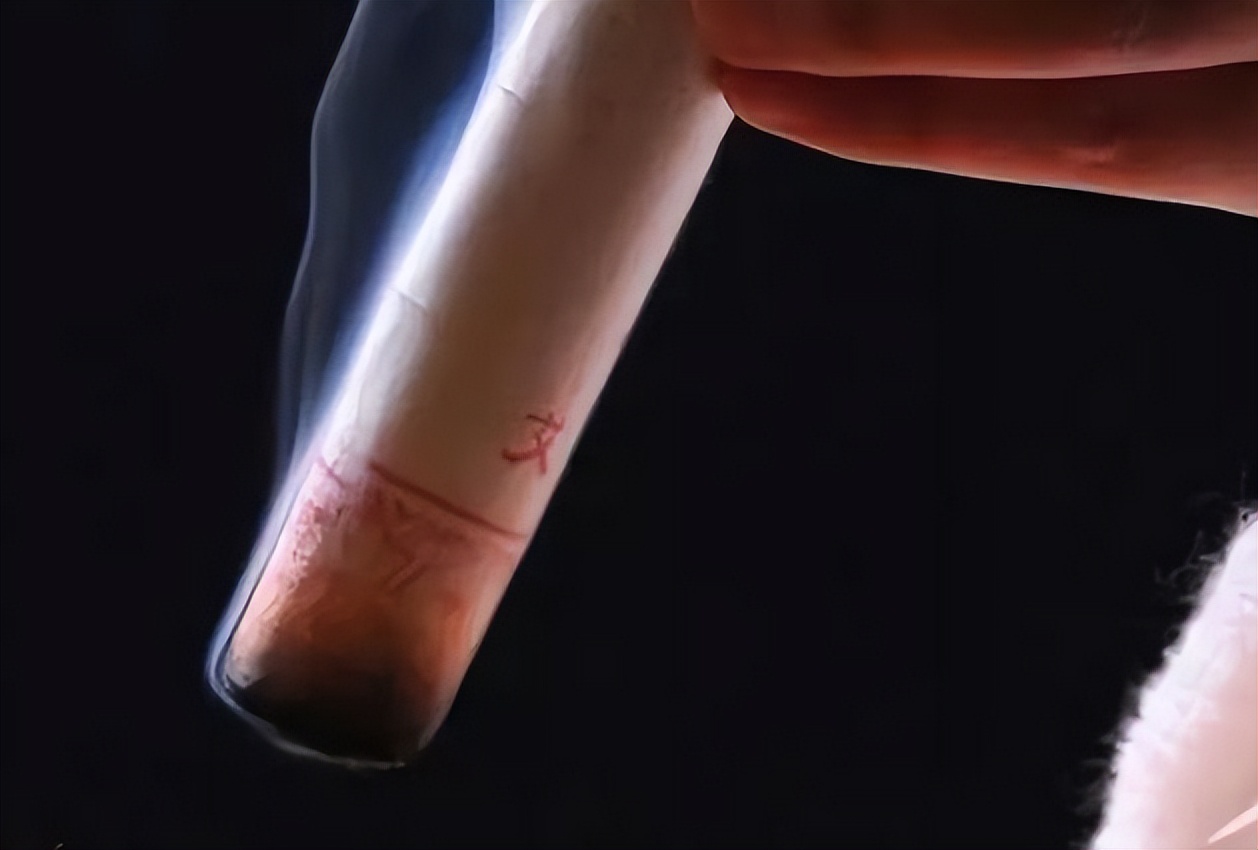 耳源性眩晕艾灸什么穴位,前庭神经眩晕艾灸哪个穴位