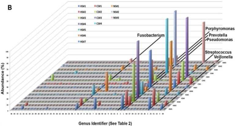 周敏教授：慢阻肺病、支扩及慢阻肺支扩重叠综合征气道微生物研究