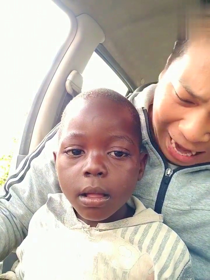 婴儿出生头卡住受伤了,宝宝出生时被卡住