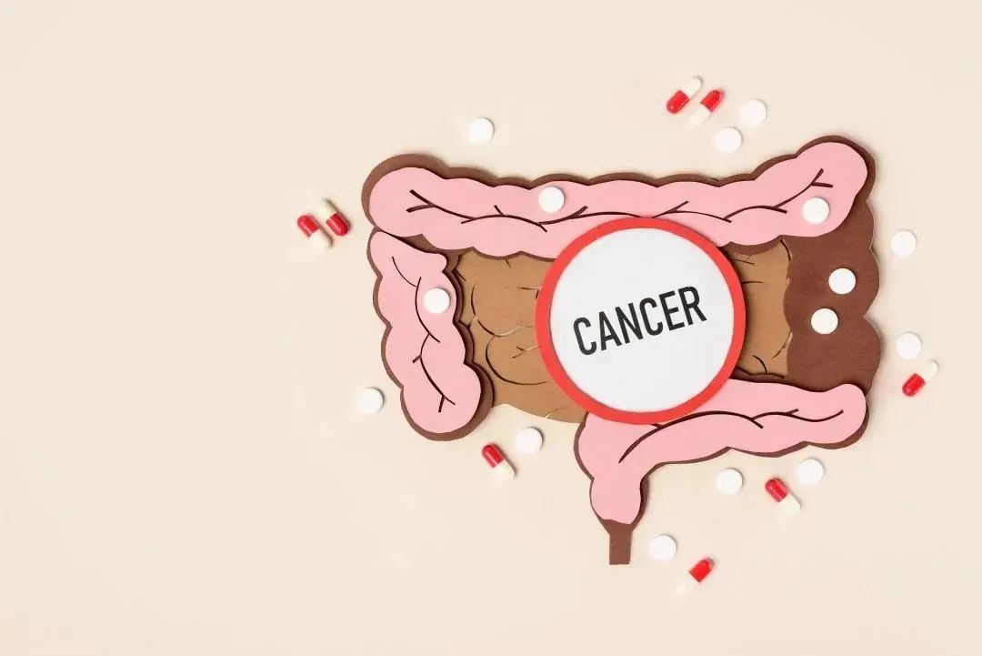 球王贝利是什么癌症,球王贝利得了什么癌症