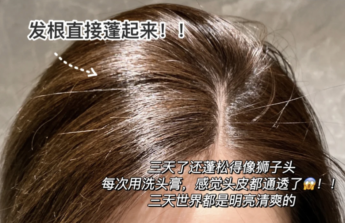 头发软细油头怎么自己弄,油头细软塌怎么洗头发才会蓬松