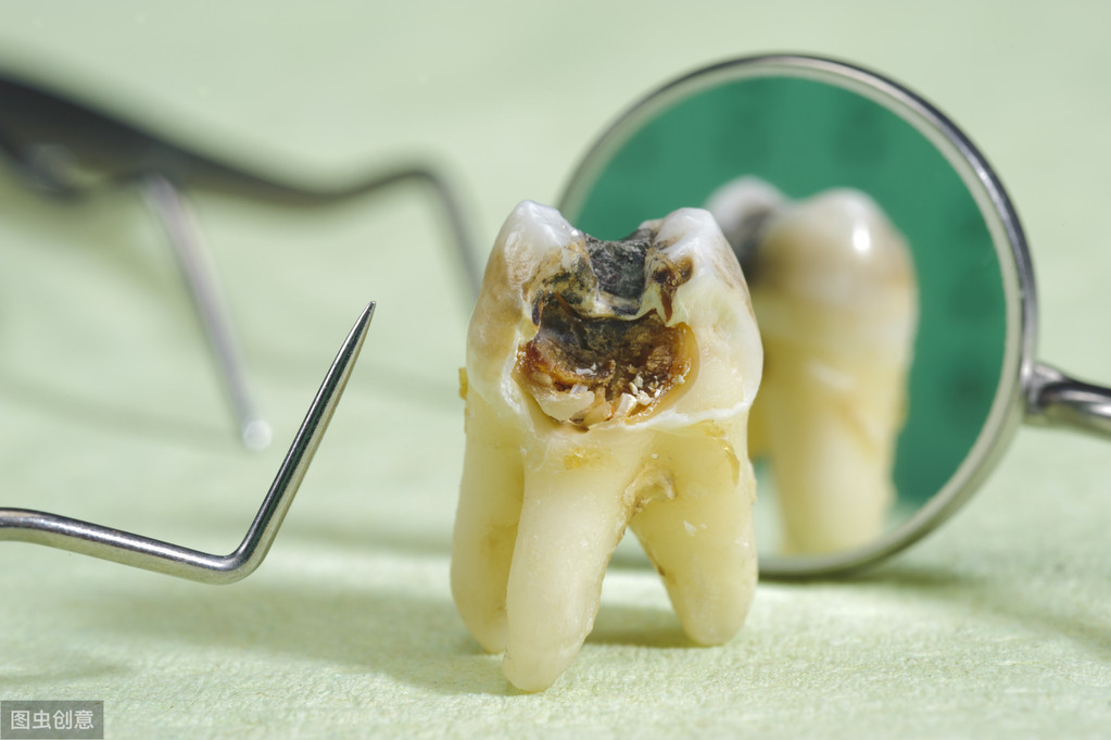 过年牙疼怎么办一招教你3秒止痛,特殊时期牙疼如何自救