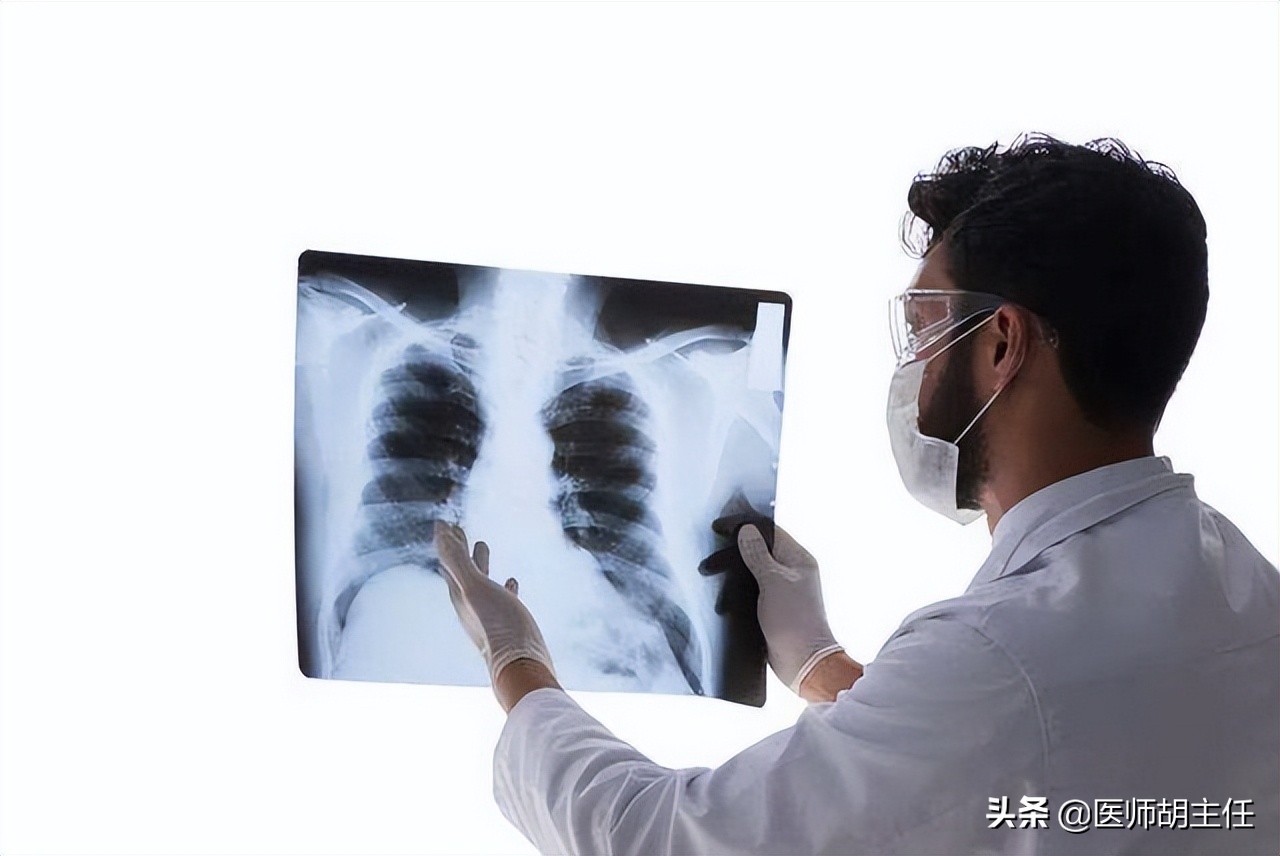 肺癌导致的肩膀疼是什么症状,肺癌导致肩膀疼痛的症状