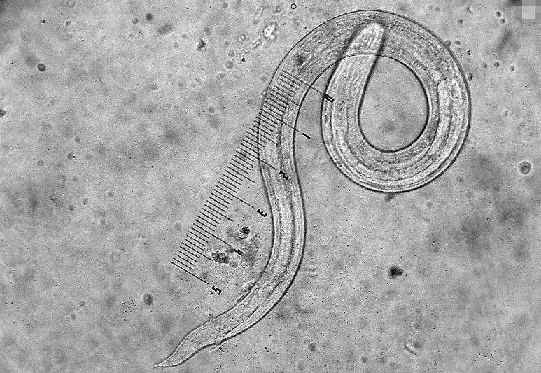 警惕食物寄生虫感染听听专家建议,5种食物易含寄生虫最好不要生吃