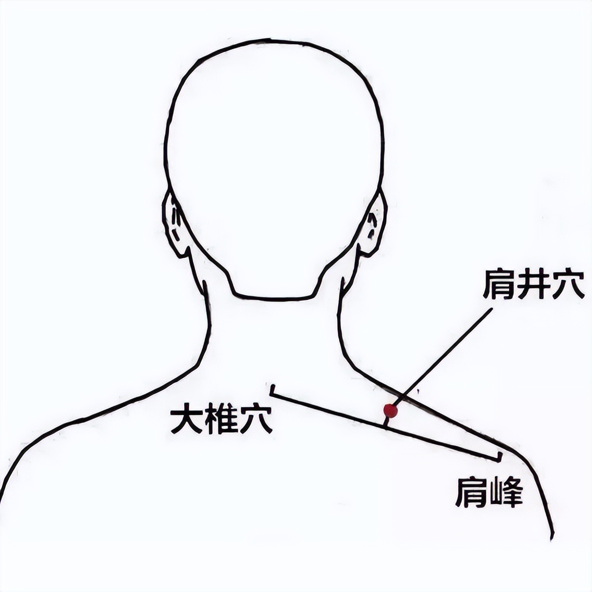 脖子一受凉就落枕这是怎么回事,脖子落枕怎样治才能好