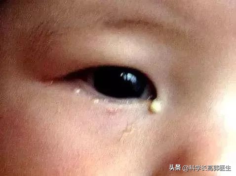 孩子咳嗽发烧反反复复是怎么回事,孩子咳嗽发烧的最佳治疗方法