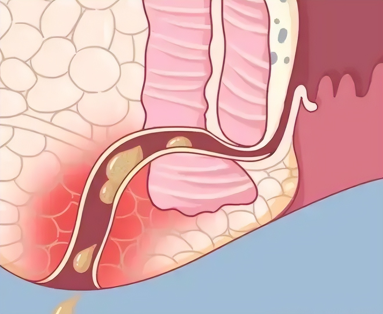 您有“洗屁股”的习惯吗？医生：经常清洗肛门，或能预防4种疾病