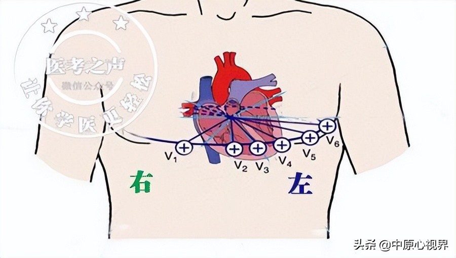 护考几种常见的心电图,常见的心电图图形分析