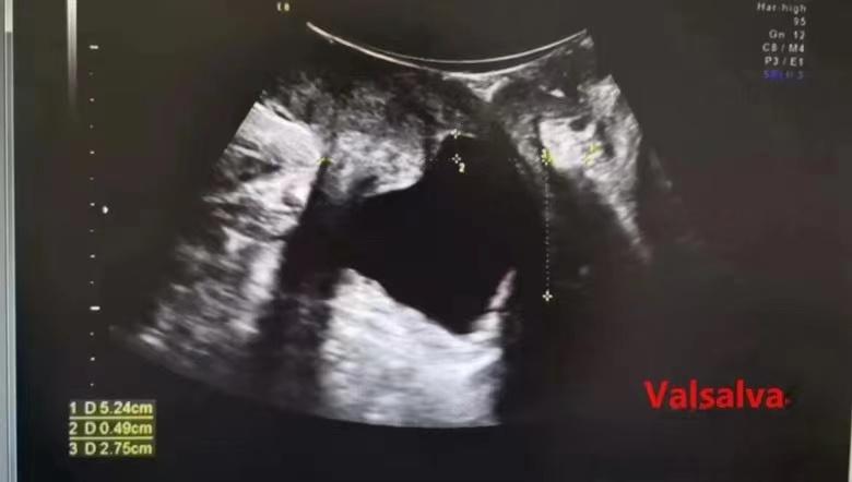 关爱女性盆底健康图片,呵护女性从盆底康复开始