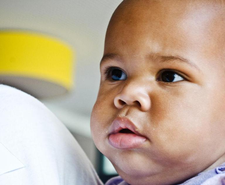 宝宝得了肝硬化怎么办,肝硬化的十个好习惯