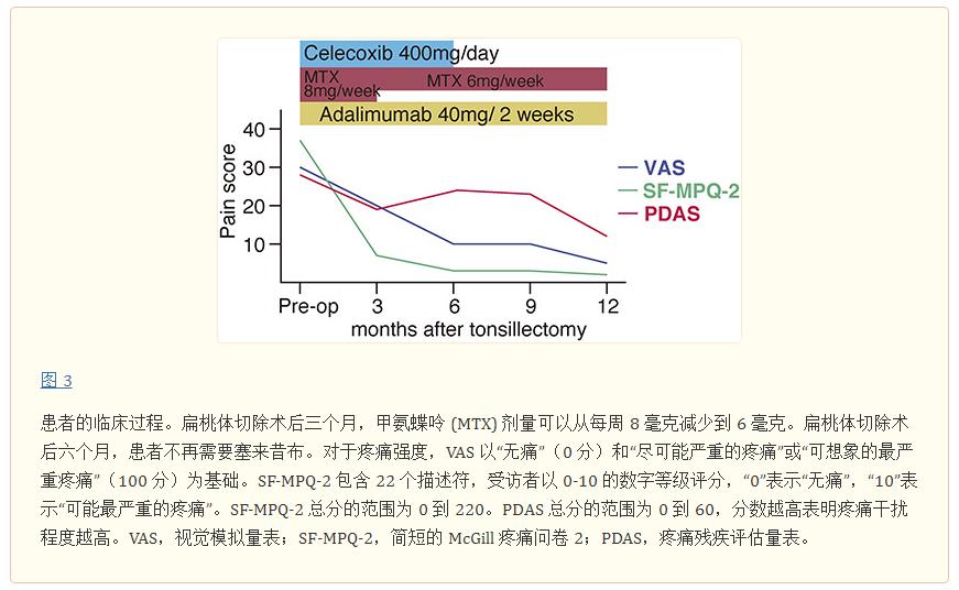 急性扁桃体切除手术的适应症,sapho综合征扁桃体切除