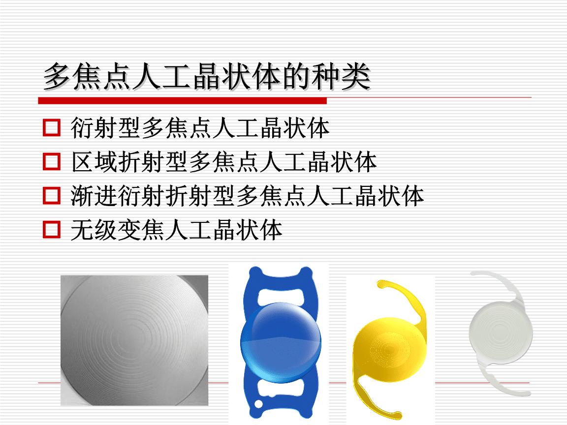 上海眼科医生飞蚊症,白内障手术后眩光什么意思