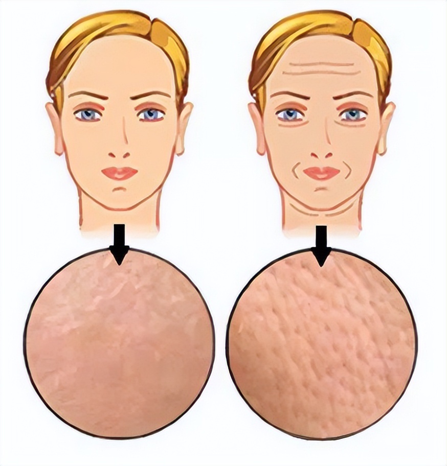 毛孔粗大如何改善治愈系,解决毛孔粗大最有效的方法医美