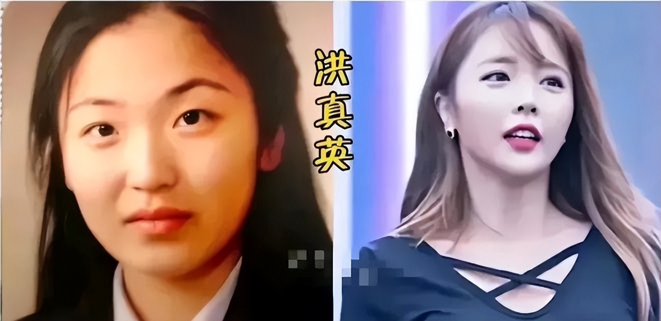 中国明星韩国整容对比,韩国明星整容变毁容