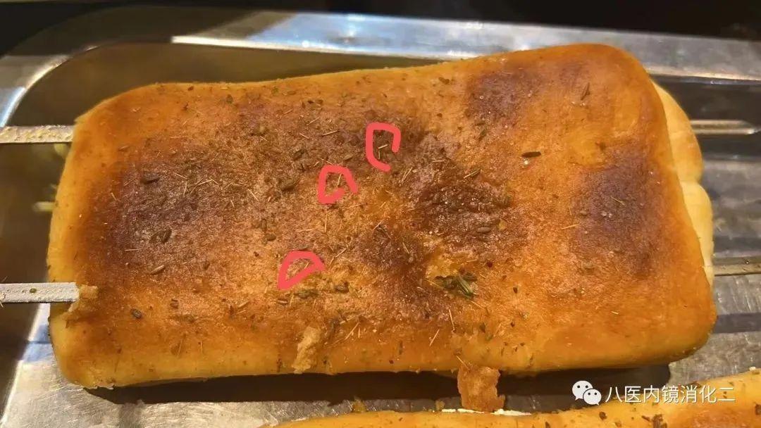 鱼刺卡喉怎么可以判断没事,鱼刺卡喉风险