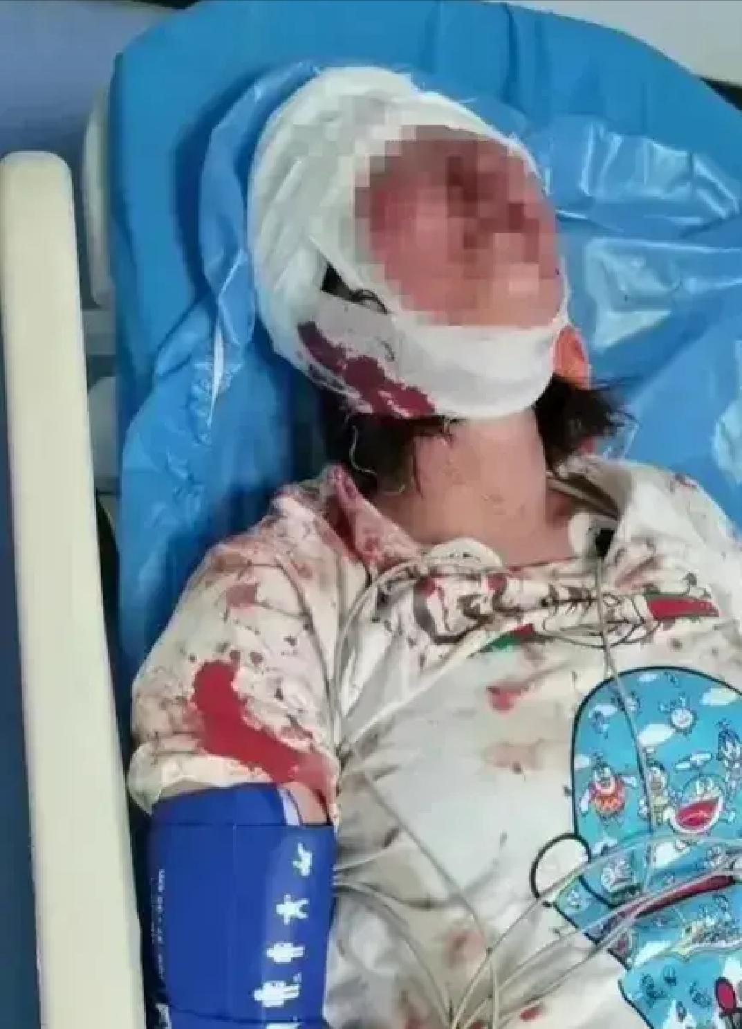 唐山烧烤店被打女子现状官方消息,唐山被打的四个女孩现状如何