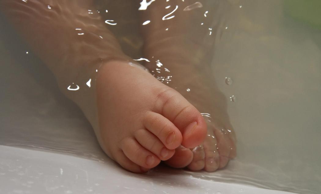 宝宝湿疹原因有哪些,宝宝湿疹有什么好的解决办法