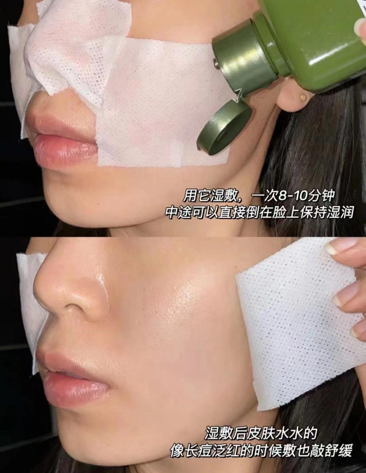 痘痘肌敏感肌良心推荐,痘痘肌敏感肌精华水推荐