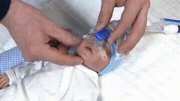 孩子肺炎住院转氨酶100-150严重吗,2个月宝宝肺炎需要住院几天