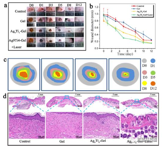 【科研快报】具有抗菌、光热和稳定的银钛氧簇水凝胶用于伤口愈合