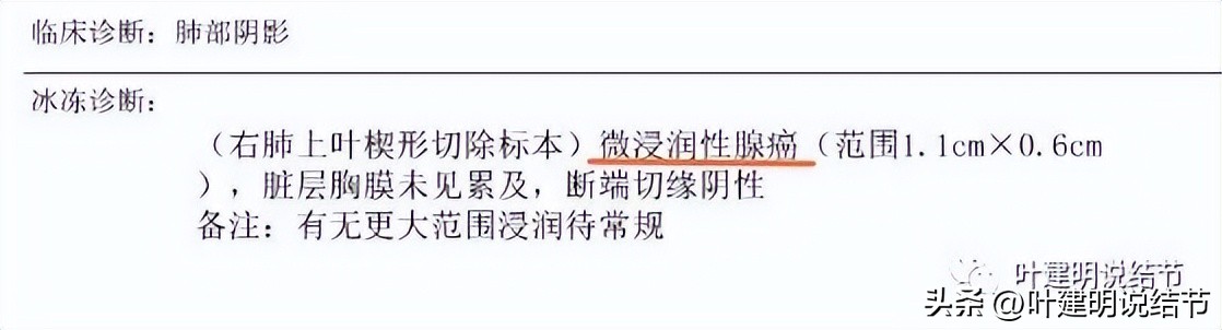 肺楔形切除肺功能降低,肺楔形切除需要缝合吗