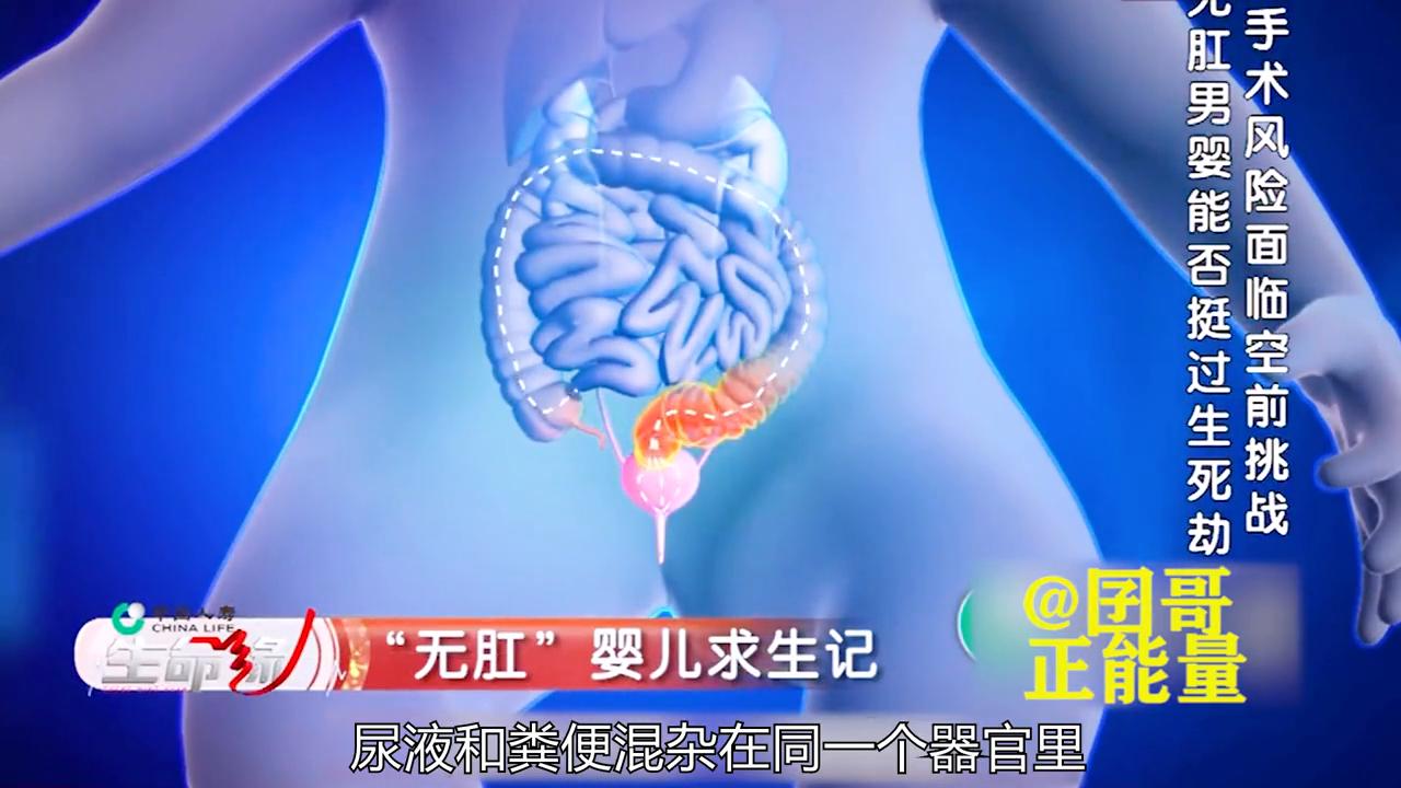 孩子出生不会排便,小孩出生16个小时没有排便