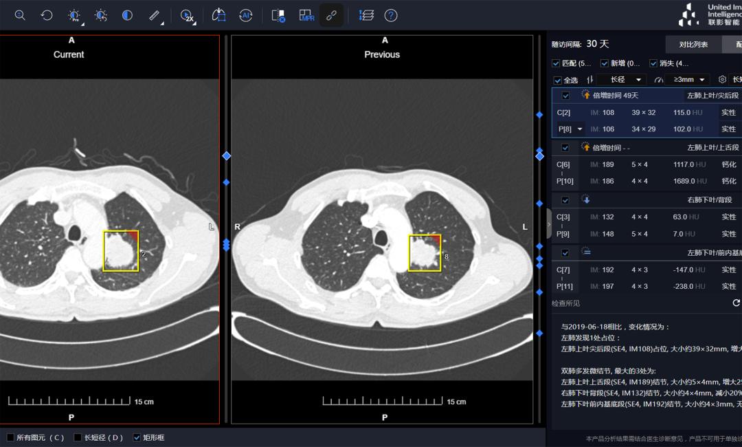 美国最新治疗肺癌特效药,治疗癌症需要的工具