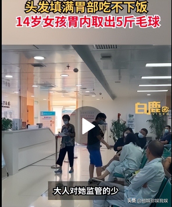 心疼西安这位14岁留守女孩，吃自己头发让胃积满5斤毛球