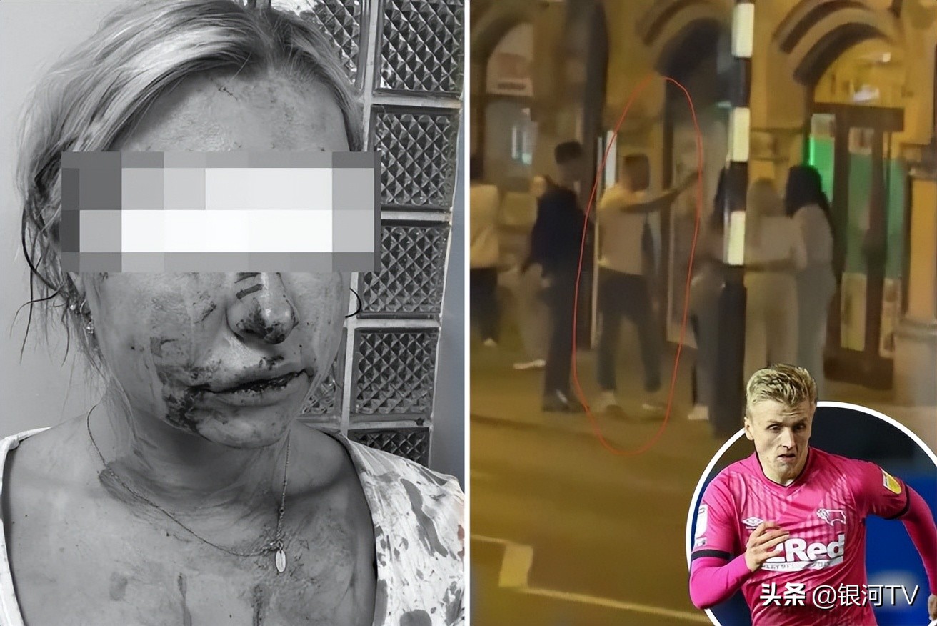 英足坛唐山打人事件！鲁尼爱徒女友被男子暴打，面部毁容（图）