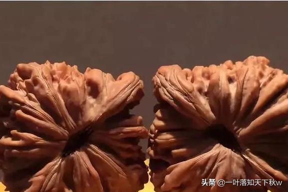 脸盲症犯了,脸盲症又犯了怎么回事