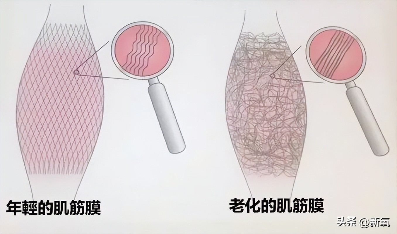 脸胖下垂是什么原因,脸肥下垂