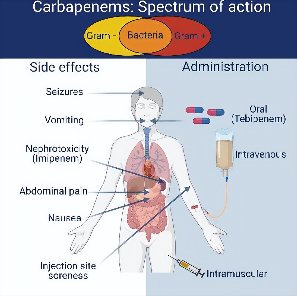 GSK和Spero共同开发TebipenemHBr治疗成人复杂性尿路感染