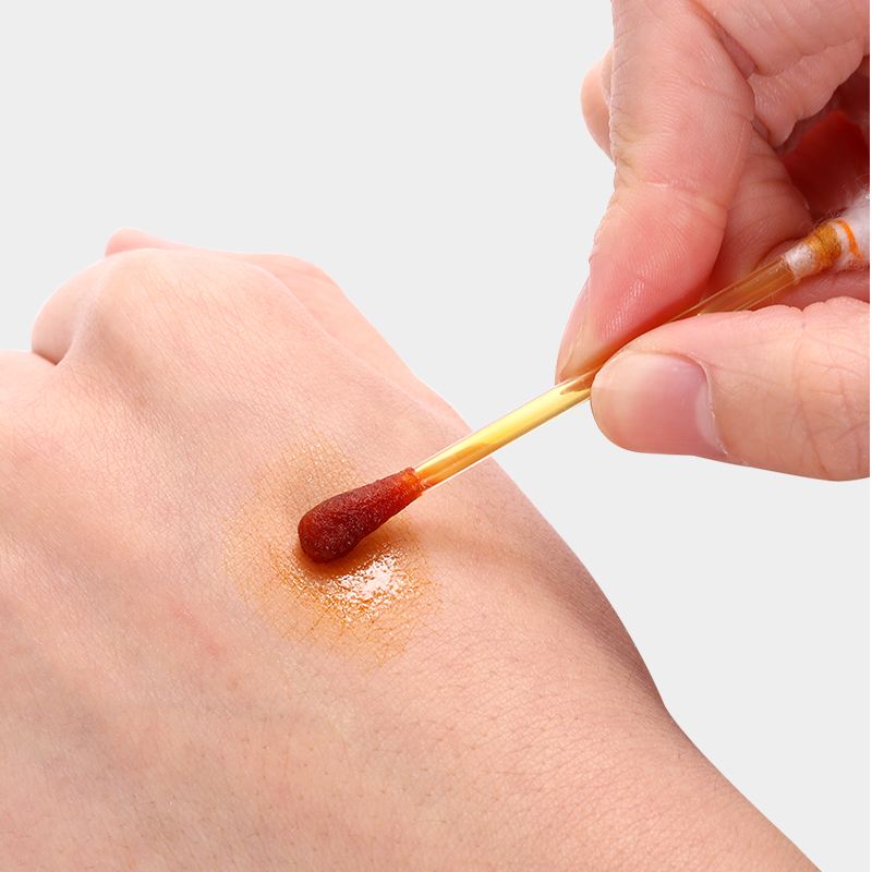 湿疹轻重与心情是否有关,湿疹跟心情有关吗