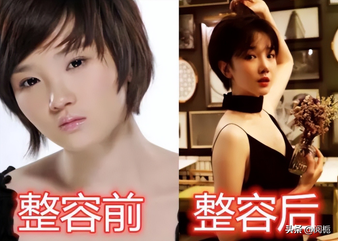 靠换脸逆天改命的六位女星,长得歪瓜裂枣整得美若天仙的明星