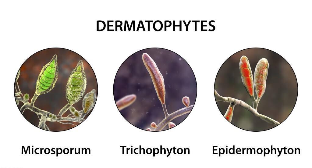 治疗灰指甲要吃抗真菌的药吗,灰指甲要吃什么抗真菌的药